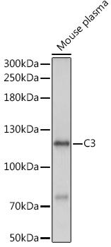 Western blot analysis of extracts of Mouse plasma using C3 Polyclonal Antibody at 1:1000 dilution.