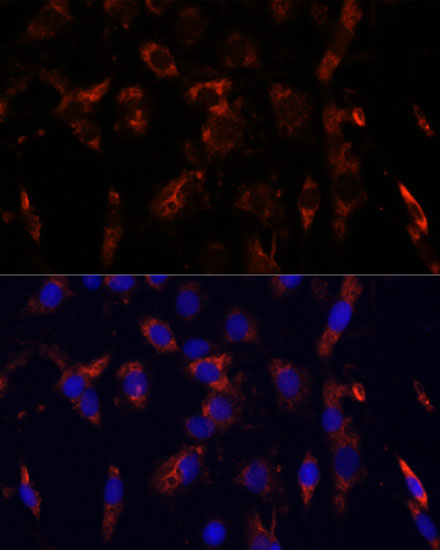 Immunofluorescence analysis of C6 cells using CD44 Polyclonal Antibody at dilution of 1:100. Blue: DAPI for nuclear staining.