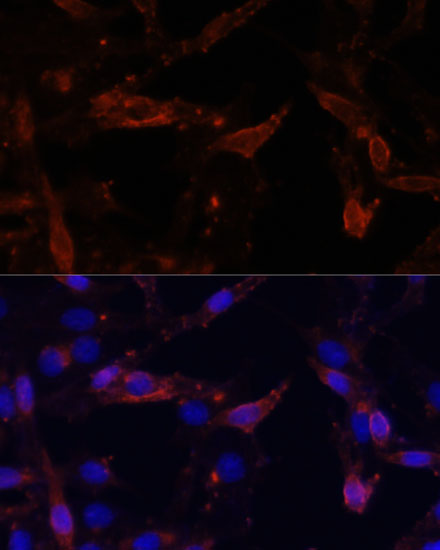 Immunofluorescence analysis of HeLa cells using CD44 Polyclonal Antibody at dilution of 1:100. Blue: DAPI for nuclear staining.