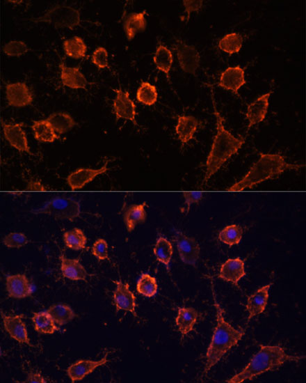 Immunofluorescence analysis of HUVEC cells using CD44 Polyclonal Antibody at dilution of 1:100. Blue: DAPI for nuclear staining.