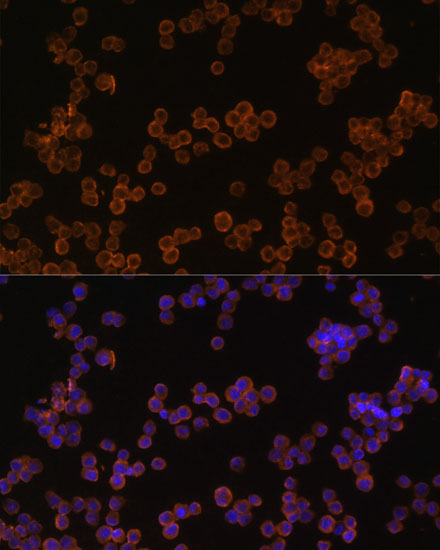 Immunofluorescence analysis of Raw264.7 cells using CD44 Polyclonal Antibody at dilution of 1:100. Blue: DAPI for nuclear staining.