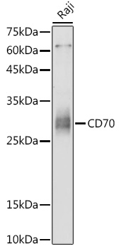 Western blot analysis of extracts of Raji cells using CD70 Polyclonal Antibody at 1:1000 dilution.