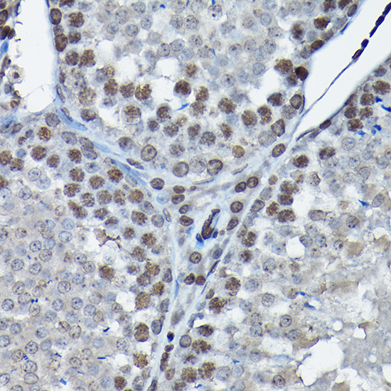 Immunohistochemistry of paraffin-embedded rat testis using CDK4 Polyclonal Antibody at dilution of 1:100 (40x lens).Perform high pressure antigen retrieval with 10 mM citrate buffer pH 6.0 before commencing with IHC staining protocol.