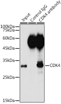 Immunoprecipitation analysis of 300ug extracts of HeLa cells using 3ug CDK4 Polyclonal Antibody. Western blot was performed from the immunoprecipitate using CDK4 Polyclonal Antibody at a dilution of 1:1000.