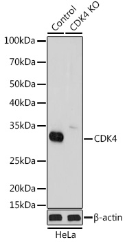 Western blot analysis of extracts from normal (control) and CDK4 knockout (KO) HeLa cells, using CDK4 Polyclonal Antibody at 1:1000 dilution.