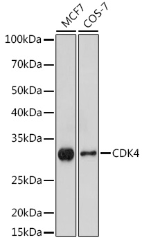 Western blot analysis of extracts of various cell lines using CDK4 Polyclonal Antibody at 1:1000 dilution.