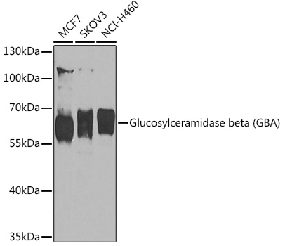 Western blot analysis of extracts of various cell lines using Glucosylceramidase beta Polyclonal Antibody at 1:1000 dilution.