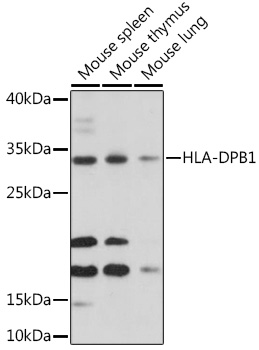 Western blot analysis of extracts of various cell lines using HLA-DPB1 Polyclonal Antibody at 1:1000 dilution.