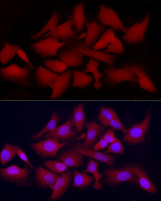 Immunofluorescence analysis of HeLa cells using [KO Validated] CDK2 Polyclonal Antibody at dilution of 1:300 (40x lens). Blue: DAPI for nuclear staining.