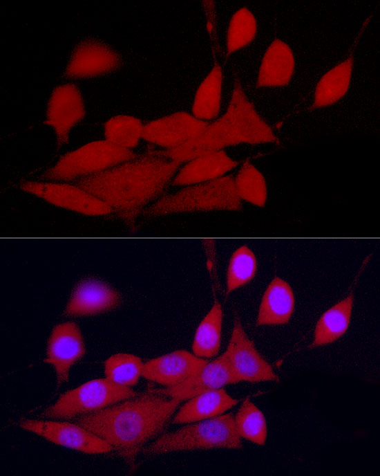 Immunofluorescence analysis of NIH/3T3 cells using [KO Validated] CDK2 Polyclonal Antibody at dilution of 1:300 (40x lens). Blue: DAPI for nuclear staining