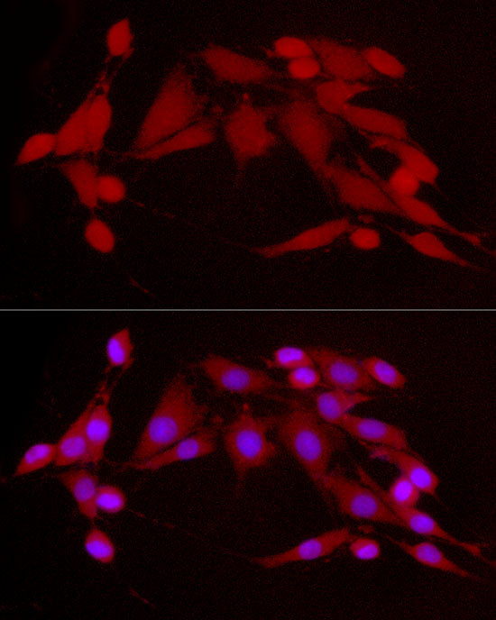 Immunofluorescence analysis of PC-12 cells using [KO Validated] CDK2 Polyclonal Antibody at dilution of 1:300 (40x lens). Blue: DAPI for nuclear staining.