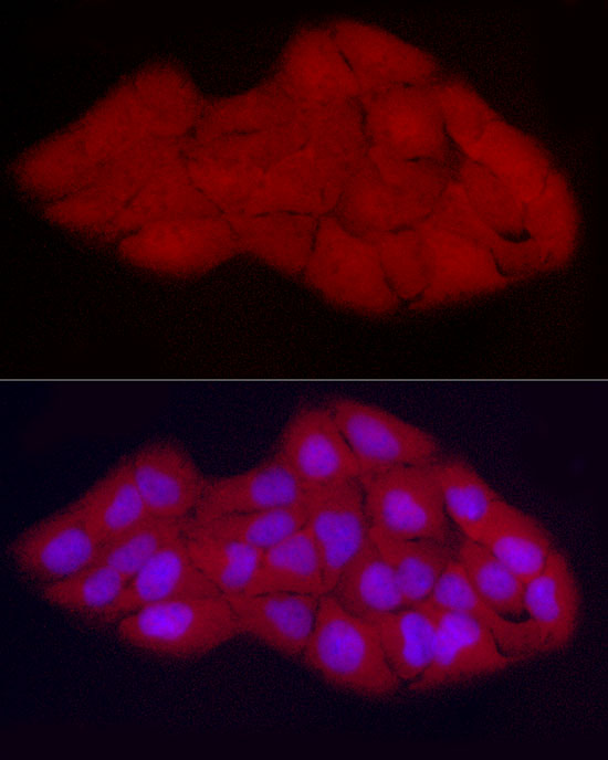 Immunofluorescence analysis of U2OS cells using [KO Validated] CDK2 Polyclonal Antibody at dilution of 1:300 (40x lens). Blue: DAPI for nuclear staining.