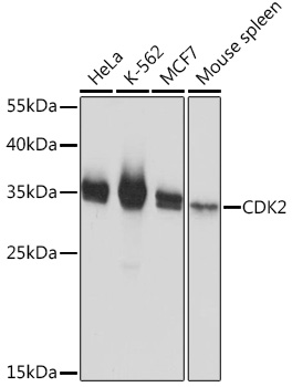 Western blot analysis of extracts of various cell lines using CDK2 Polyclonal Antibody at 1:1000 dilution.