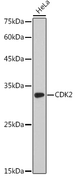 Western blot analysis of extracts of HeLa cells using CDK2 Polyclonal Antibody at 1:1000 dilution.