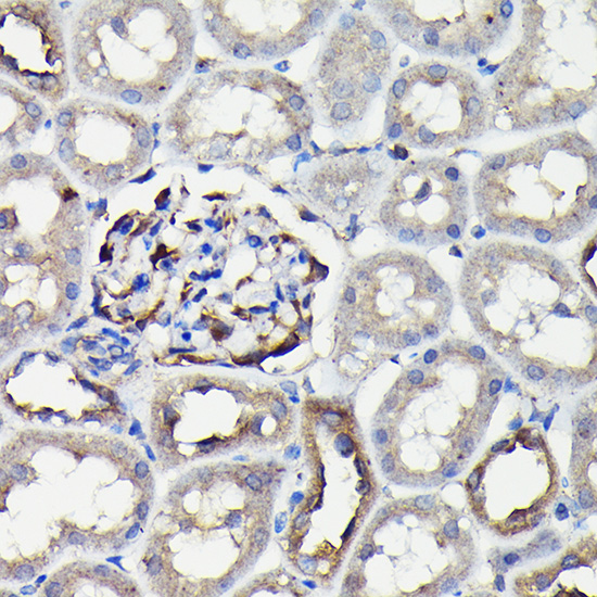 Immunohistochemistry of paraffin-embedded rat kidney using MYH9 Polyclonal Antibody at dilution of 1:100 (40x lens).Perform high pressure antigen retrieval with 10 mM citrate buffer pH 6.0 before commencing with IHC staining protocol.