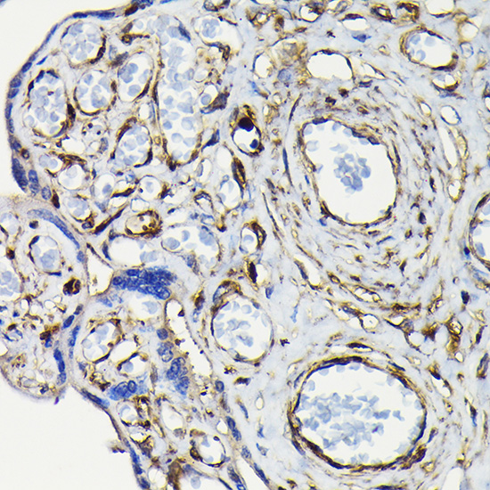 Immunohistochemistry of paraffin-embedded human placenta using MYH9 Polyclonal Antibody at dilution of 1:100 (40x lens).Perform high pressure antigen retrieval with 10 mM citrate buffer pH 6.0 before commencing with IHC staining protocol.