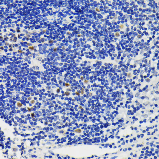 Immunohistochemistry of paraffin-embedded human appendix using NFAT2 Polyclonal Antibody at dilution of 1:200 (40x lens).Perform microwave antigen retrieval with 10 mM PBS buffer pH 7.2 before commencing with IHC staining protocol.