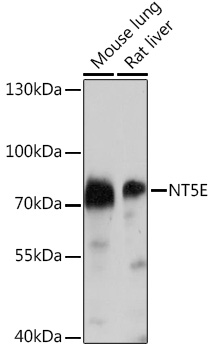 Western blot analysis of extracts of various cell lines using CD73/NT5E Polyclonal Antibody at 1:1000 dilution.