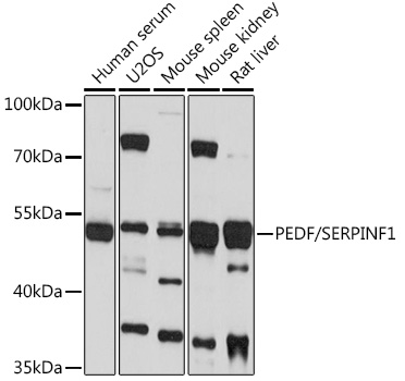 Western blot analysis of extracts of various cell lines using PEDF/PEDF/SERPINF1 Polyclonal Antibody at 1:1000 dilution.