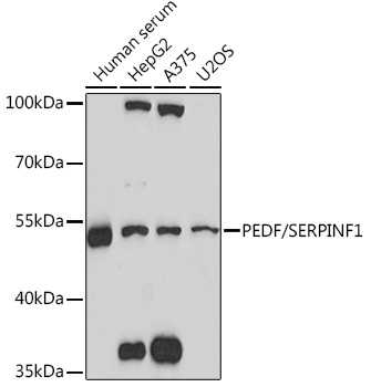 Western blot analysis of extracts of various cell lines using PEDF/PEDF/SERPINF1 Polyclonal Antibody at 1:1000 dilution.