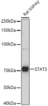 Western blot analysis of extracts of Rat kidney cells using STAT3 Polyclonal Antibody at 1:1000 dilution.