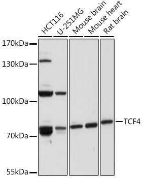 Western blot analysis of extracts of various cell lines using TCF4 Polyclonal Antibody at 1:1000 dilution.