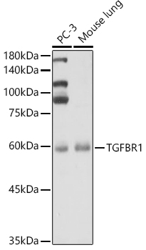 Western blot analysis of extracts of various cell lines using TGFBR1 Polyclonal Antibody at 1:1000 dilution.