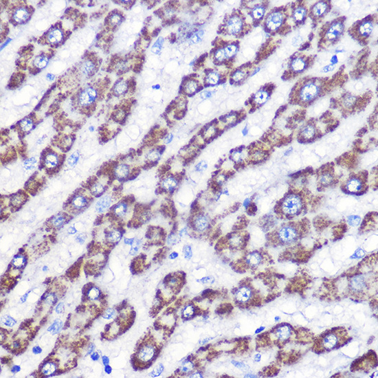 Immunohistochemistry of paraffin-embedded human liver using UCP3 Polyclonal Antibody at dilution of 1:100 (40x lens).Perform microwave antigen retrieval with 10 mM Tris/EDTA buffer pH 9.0 before commencing with IHC staining protocol.