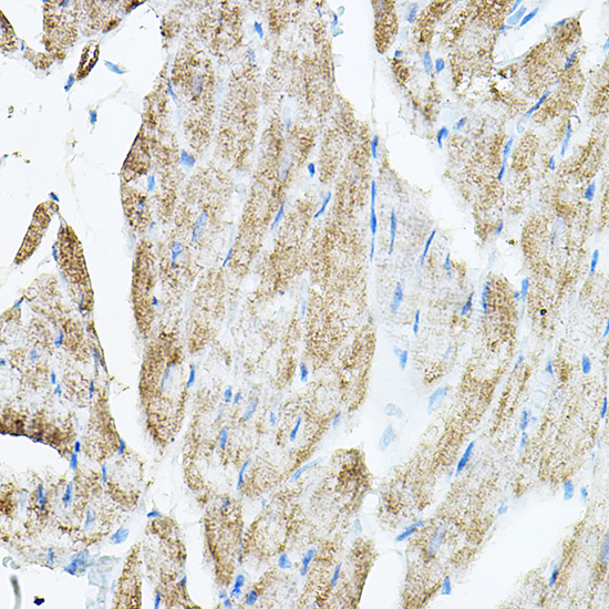 Immunohistochemistry of paraffin-embedded rat heart using VEGFB Polyclonal Antibody at dilution of 1:150 (40x lens).Perform high pressure antigen retrieval with 10 mM citrate buffer pH 6.0 before commencing with IHC staining protocol.