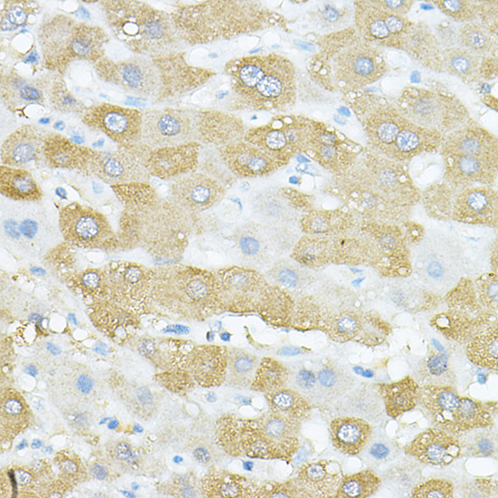 Immunohistochemistry of paraffin-embedded human liver using VEGFB Polyclonal Antibody at dilution of 1:100 (40x lens).Perform high pressure antigen retrieval with 10 mM citrate buffer pH 6.0 before commencing with IHC staining protocol.