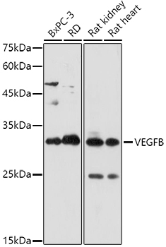 Western blot analysis of extracts of various cell lines using VEGFB Polyclonal Antibody at 1:1000 dilution.