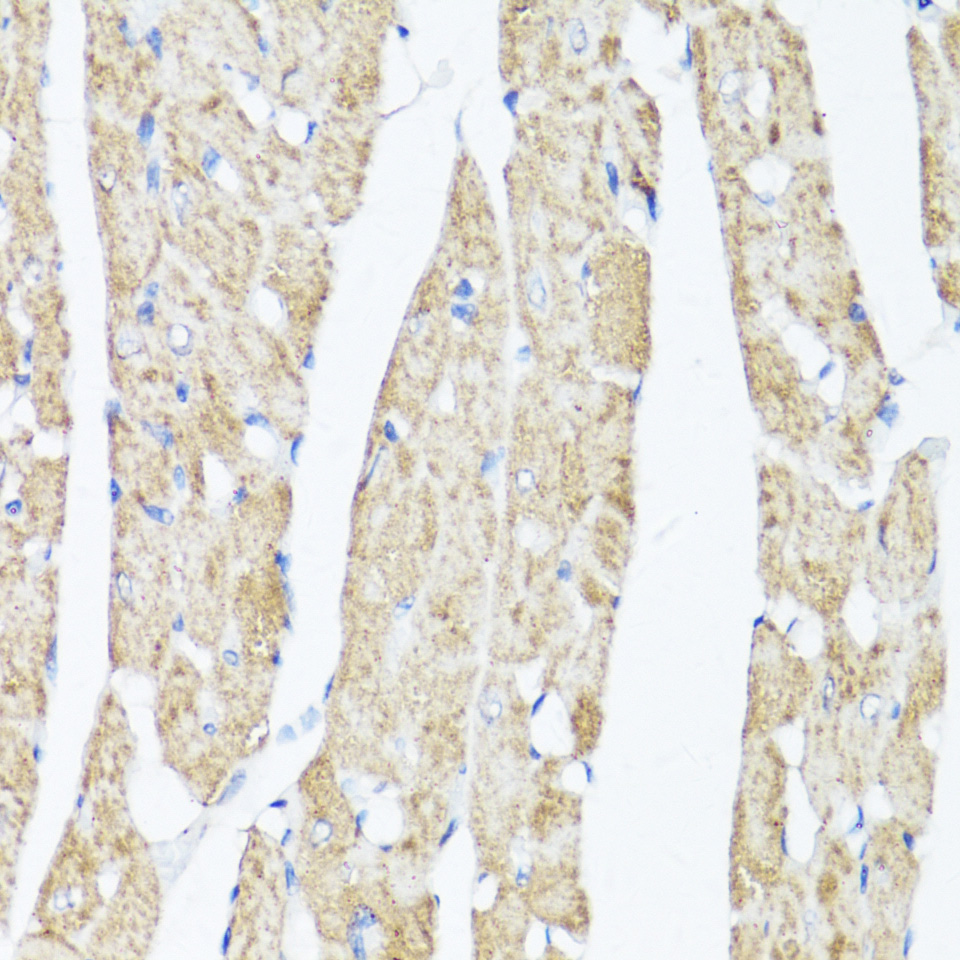 Immunohistochemistry of paraffin-embedded Rat heart using XBP1s Polyclonal Antibody at dilution of 1:100 (40x lens).Perform microwave antigen retrieval with 10 mM PBS buffer pH 7.2 before commencing with IHC staining protocol.