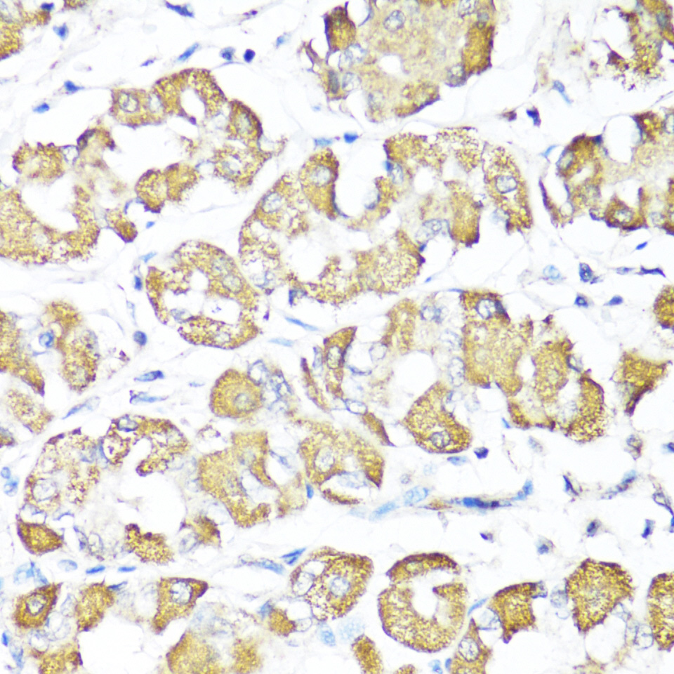 Immunohistochemistry of paraffin-embedded Human stomach using XBP1s Polyclonal Antibody at dilution of 1:100 (40x lens).Perform microwave antigen retrieval with 10 mM PBS buffer pH 7.2 before commencing with IHC staining protocol.