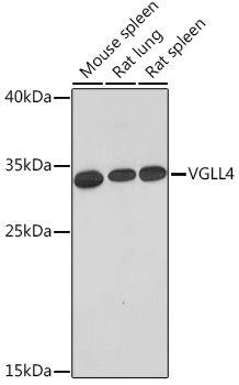 Western blot analysis of extracts of various cell lines using VGLL4 Polyclonal Antibody at 1:1000 dilution.