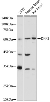 Western blot analysis of extracts of various cell lines using DKK3 Polyclonal Antibody at 1:1000 dilution.