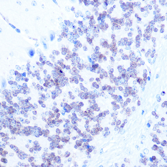 Immunohistochemistry of paraffin-embedded Mouse brain using NeuN Polyclonal Antibody at dilution of 1:100 (40x lens).Perform microwave antigen retrieval with 10 mM Tris/EDTA buffer pH 9.0 before commencing with IHC staining protocol.