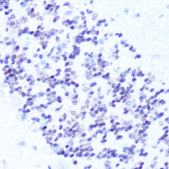 Immunohistochemistry of paraffin-embedded Rat brain using NeuN Polyclonal Antibody at dilution of 1:100 (40x lens).Perform microwave antigen retrieval with 10 mM Tris/EDTA buffer pH 9.0 before commencing with IHC staining protocol.