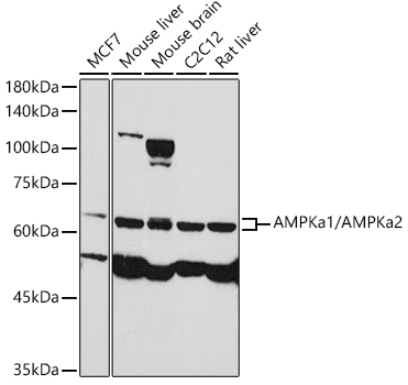 Western blot analysis of extracts of various cell lines using AMPKa1/AMPKa2 Polyclonal Antibody at 1:1000 dilution.