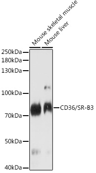 Western blot analysis of extracts of various cell lines using CD36/SR-B3 Polyclonal Antibody at 1:1000 dilution.