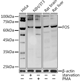 Western blot analysis of extracts of various cell lines using FOS Polyclonal Antibody at 1:1000 dilution.NIH/3T3 cells were treated by Serum-starvation overnight at 37℃.NIH/3T3 cells were treated by PMA/TPA (200 nM) at 37℃ for 15 minutes after serum-starvation overnight.