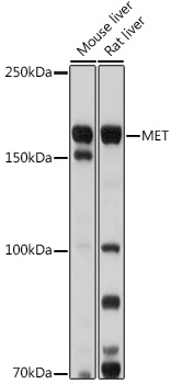 Western blot analysis of extracts of various cell lines using MET Polyclonal Antibody at 1:1000 dilution.