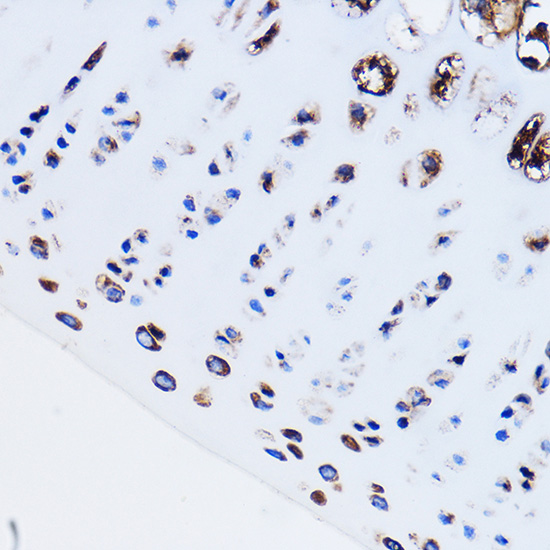 Immunohistochemistry of paraffin-embedded Rat leg bone using PTH1R Polyclonal Antibody at dilution of 1:100 (40x lens).Perform microwave antigen retrieval with 10 mM PBS buffer pH 7.2 before commencing with IHC staining protocol.