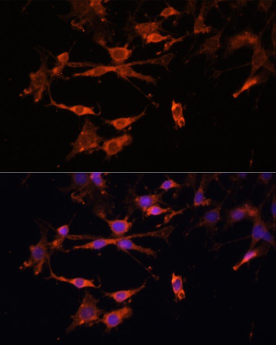 Immunofluorescence analysis of C6 cells using HLA-DPB1 Polyclonal Antibody at dilution of 1:100. Blue: DAPI for nuclear staining.