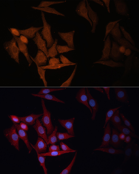 Immunofluorescence analysis of HeLa cells using HLA-DPB1 Polyclonal Antibody at dilution of 1:100. Blue: DAPI for nuclear staining.