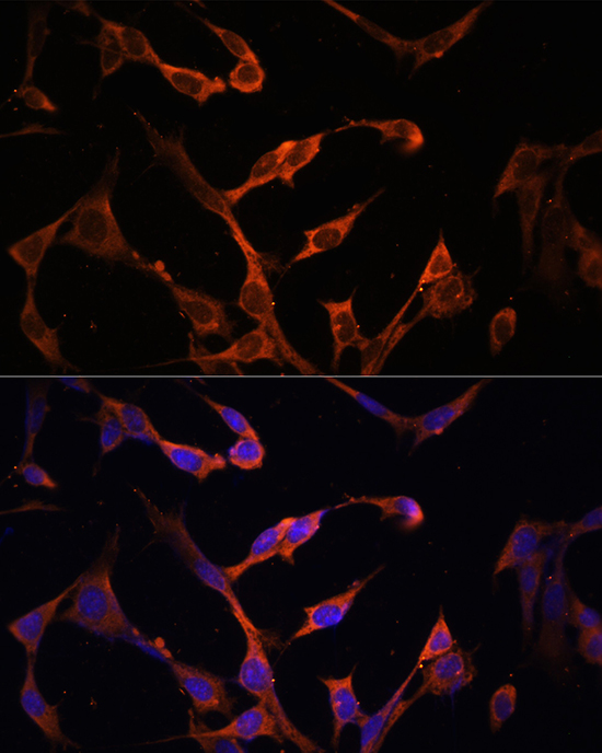 Immunofluorescence analysis of NIH/3T3 cells using HLA-DPB1 Polyclonal Antibody at dilution of 1:100. Blue: DAPI for nuclear staining.