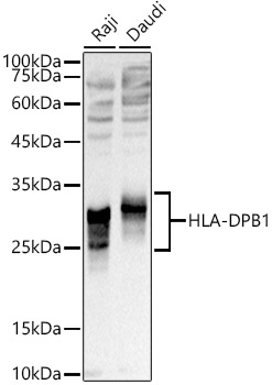 Western blot analysis of extracts of various cell lines using HLA-DPB1  Polyclonal Antibody at 1:1000 dilution.