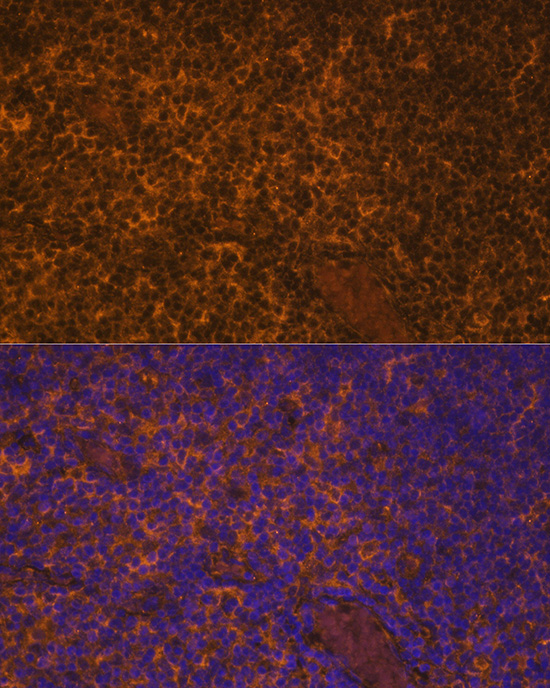 Immunofluorescence analysis of Rat thymus using IL10 Polyclonal Antibody at dilution of 1:100. Blue: DAPI for nuclear staining.