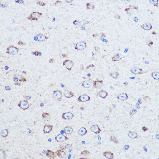 Immunohistochemistry of paraffin-embedded mouse brain using RELN Polyclonal Antibody at dilution of 1:100 (40x lens).Perform microwave antigen retrieval with 10 mM Tris/EDTA buffer pH 9.0 before commencing with IHC staining protocol.