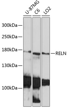 Western blot analysis of extracts of various cell lines using RELN Polyclonal Antibody at 1:1000 dilution.