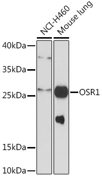 Western blot analysis of extracts of various cell lines using OSR1 Polyclonal Antibody at 1:1000 dilution.